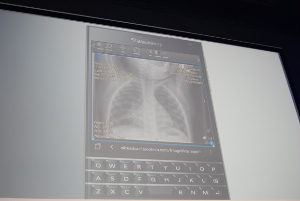 Claron Technology Inc. shows how doctors can use the Passport to display x-ray images